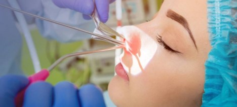 Cost of Nasal Endoscopy in Singapore