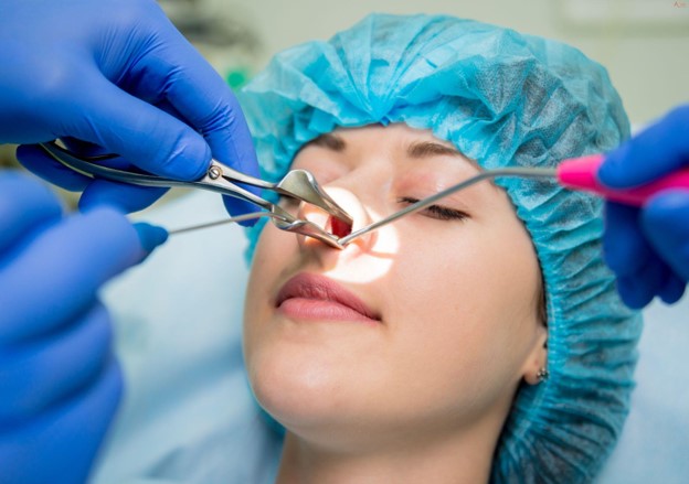 What Conditions Can a Nose Scope Help Diagnose